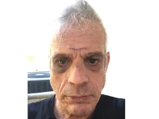 Guest Opinion: My short film helped me heal